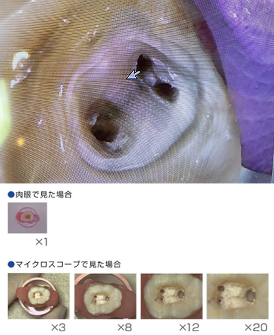 「可視化」による適切な診断