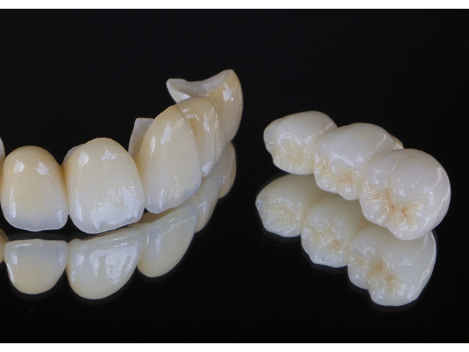 ジルコニアセラミック