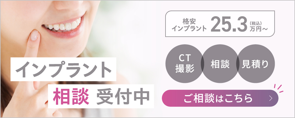 インプラント　相談受け付け中