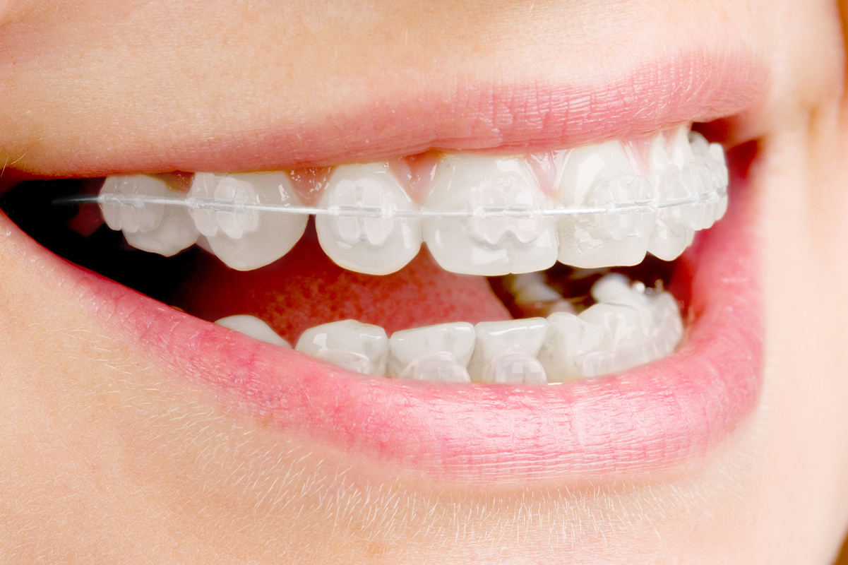 1.症例や目的に合わせた選択が可能