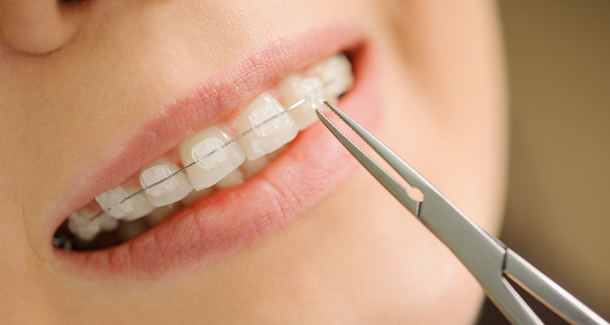 細かな調整がしやすい