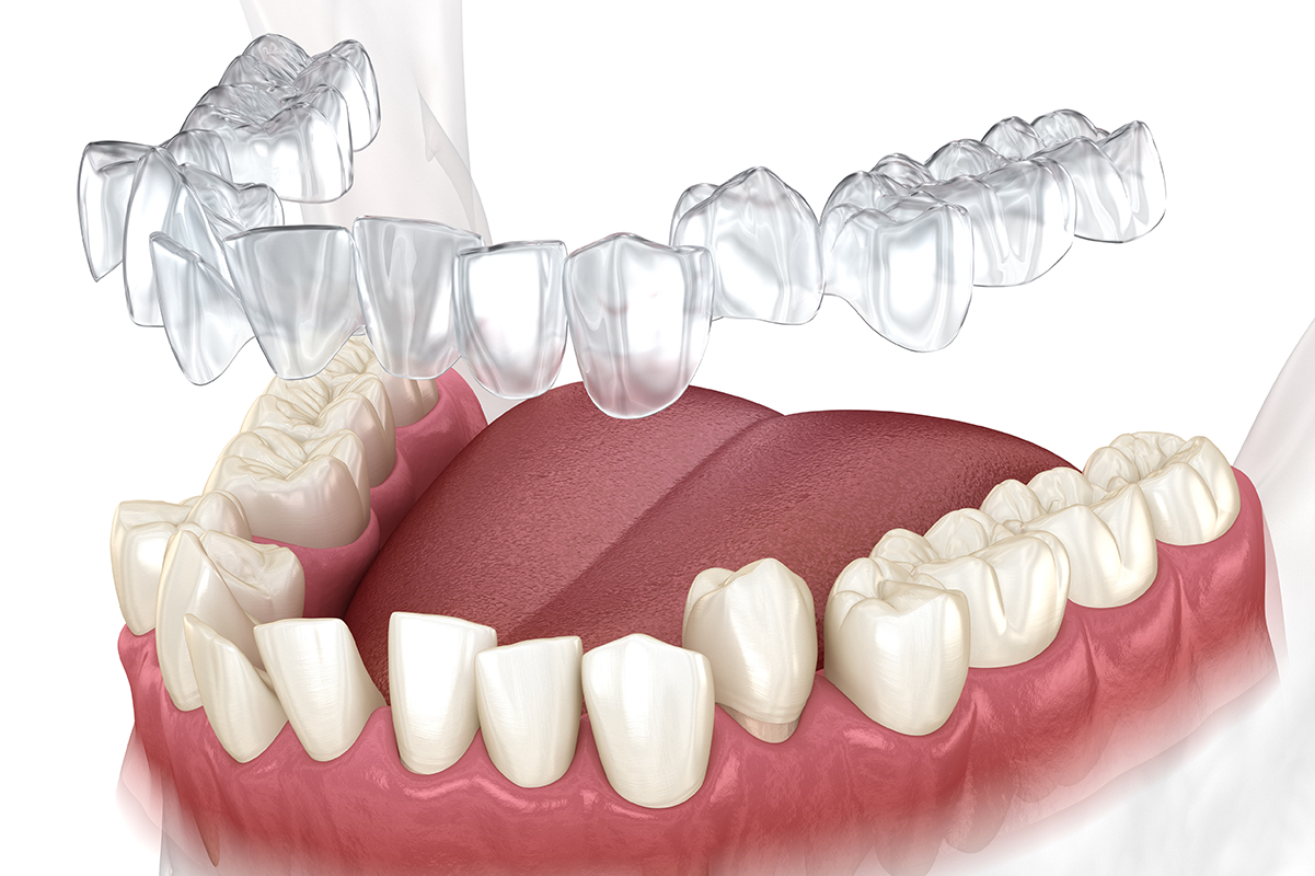 1.症例や目的に合わせた選択が可能