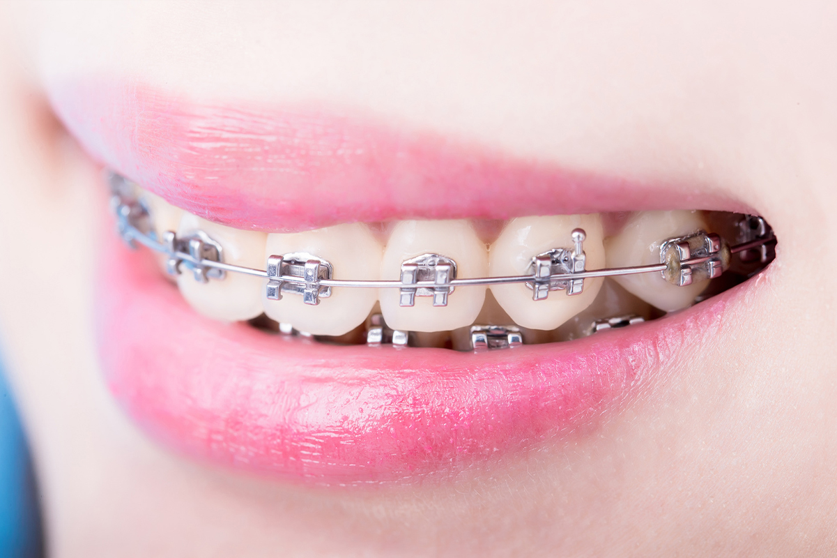 1.症例や目的に合わせた選択が可能