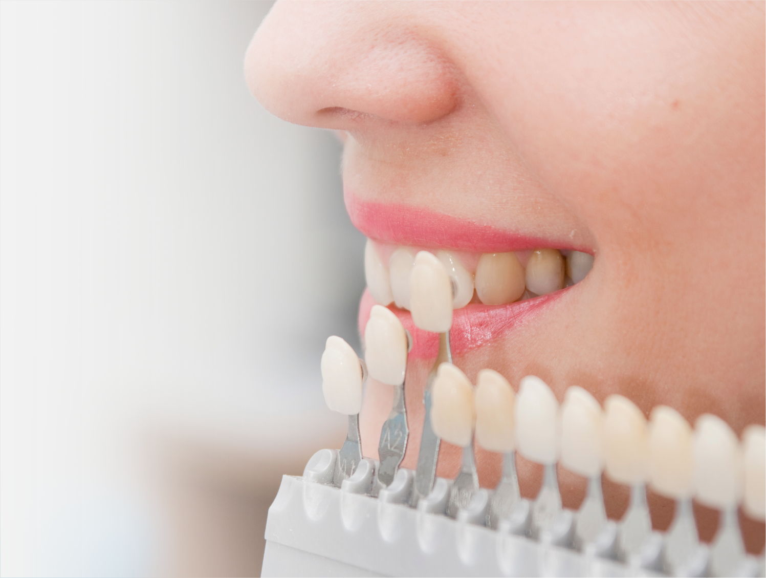 ホワイトニング