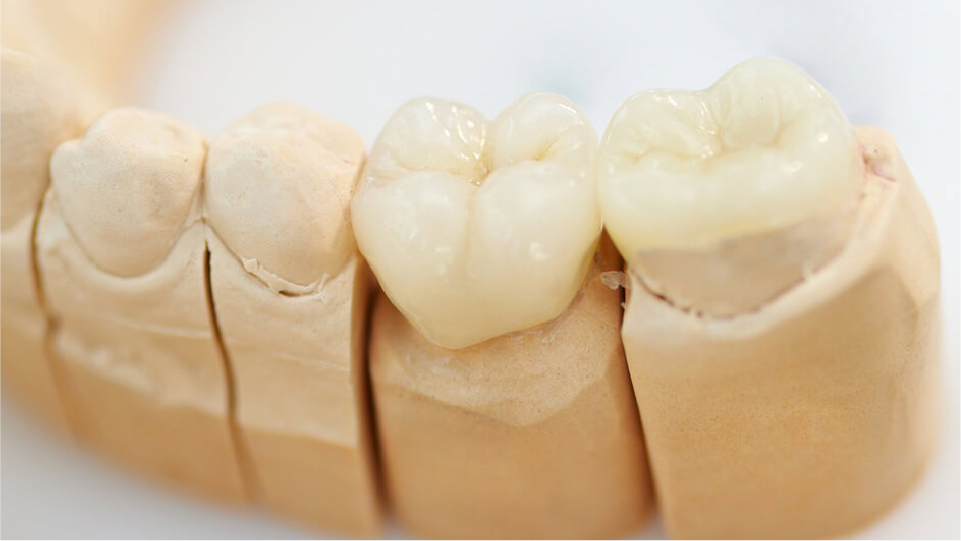 保険診療と自由診療