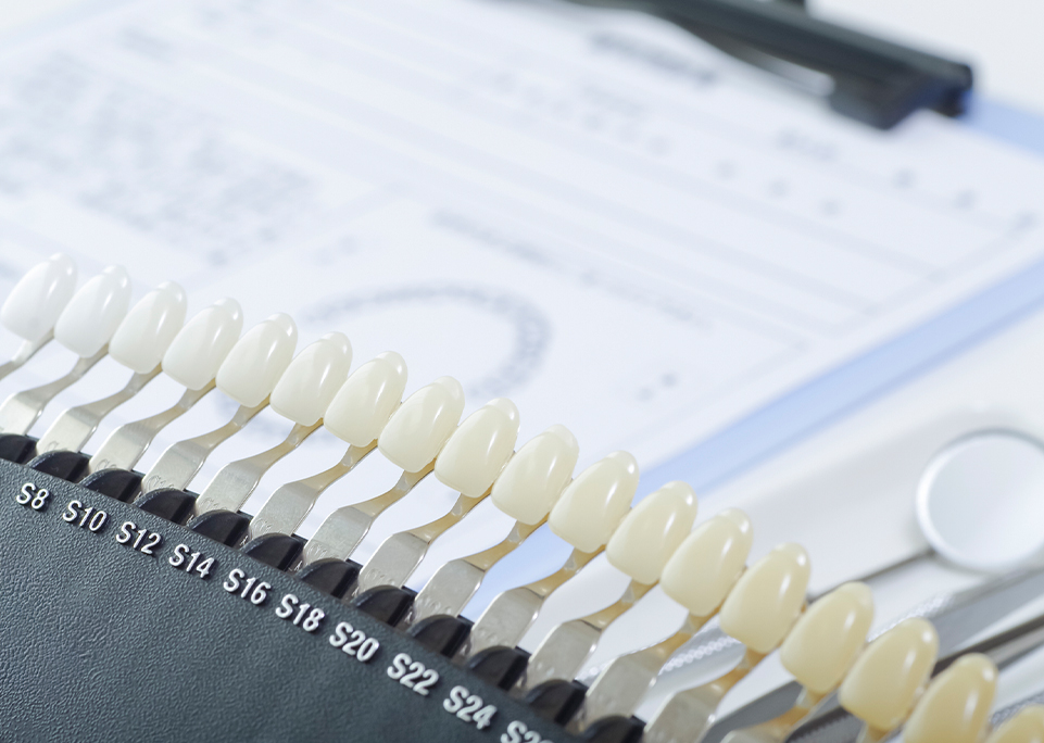 施術方法のご説明、歯の色の確認