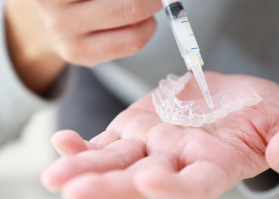 ホームホワイトニングの実施