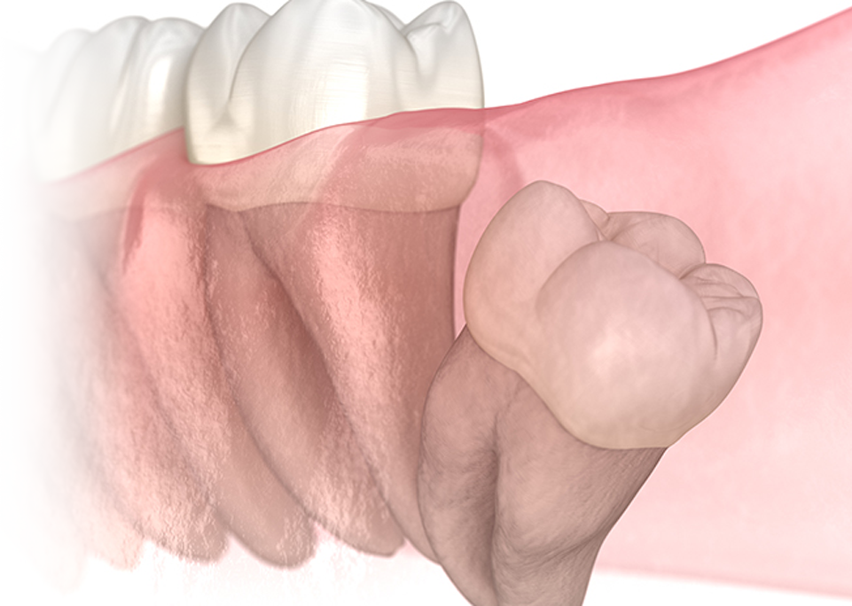 処置にかかる時間をお伝えします