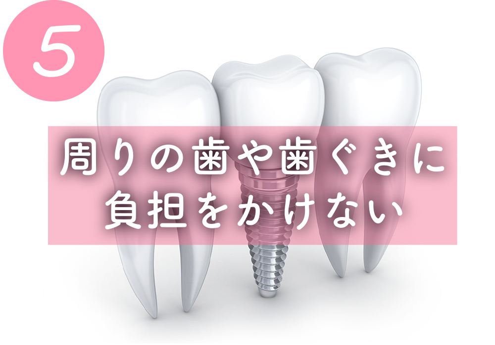 周りの歯や歯ぐきに
負担をかけない