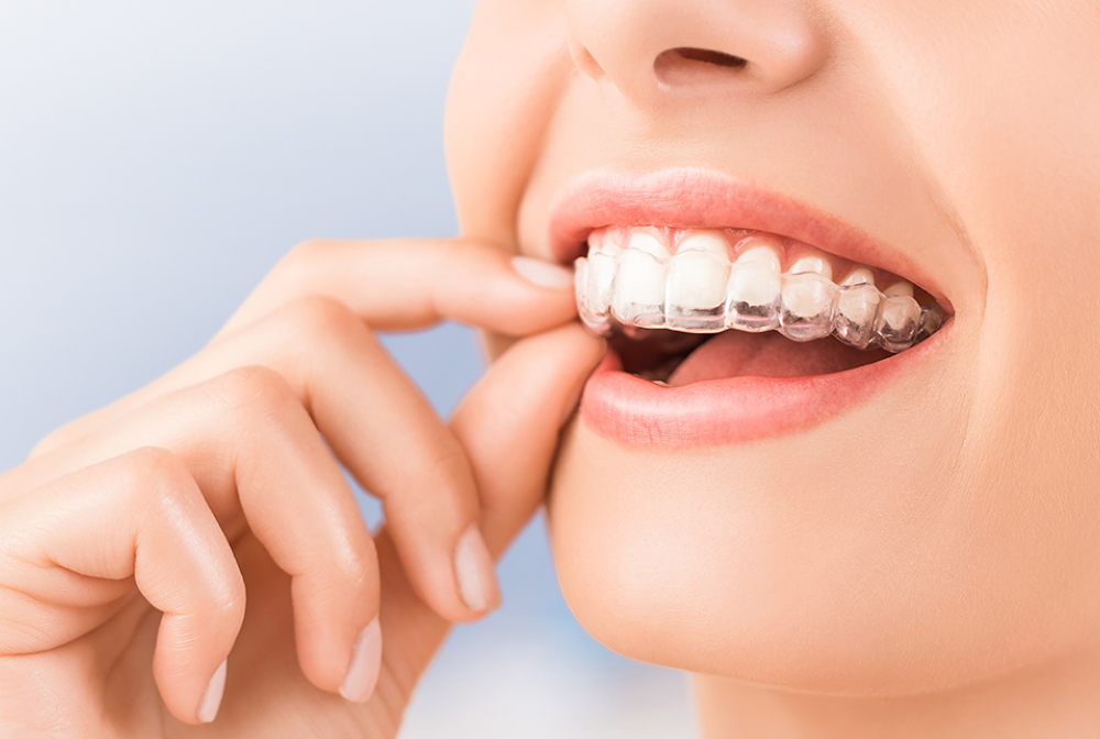 症例に合わせて
種類が選べる